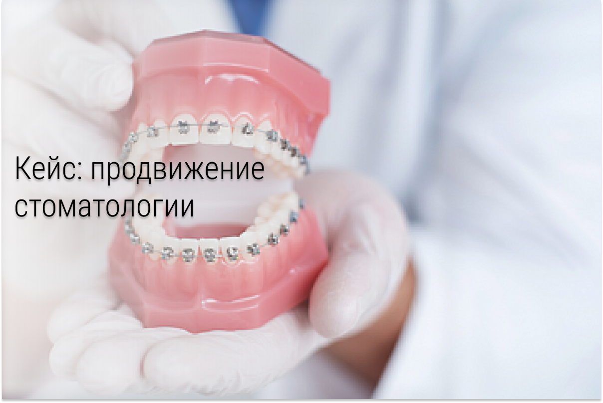Кейс: пациенты в стоматологию по 657 рублей (имплантация)