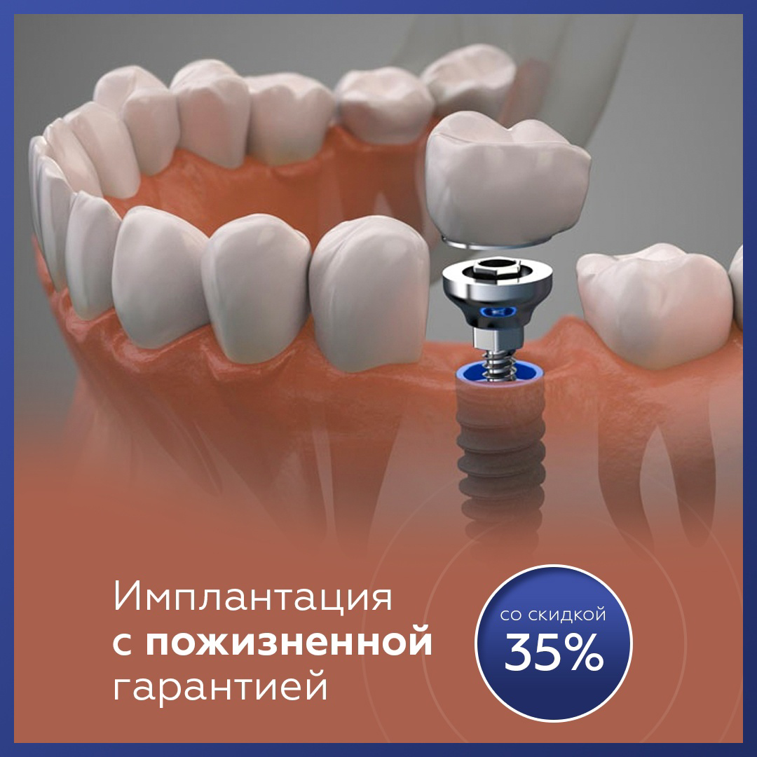 Кейс: пациенты в стоматологию по 657 рублей (имплантация) — иллюстрация 6