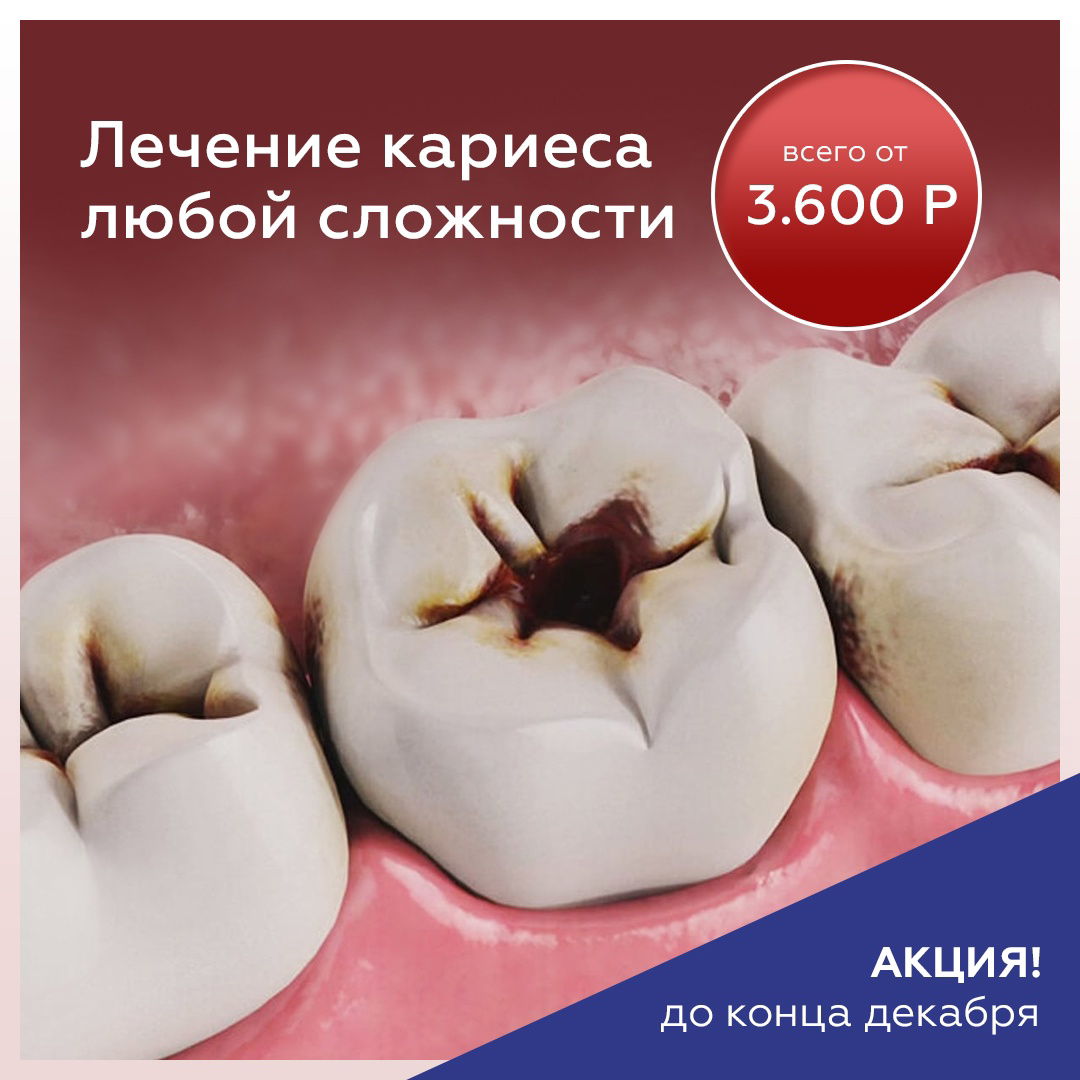 Кейс: пациенты в стоматологию по 657 рублей (имплантация) — иллюстрация 7