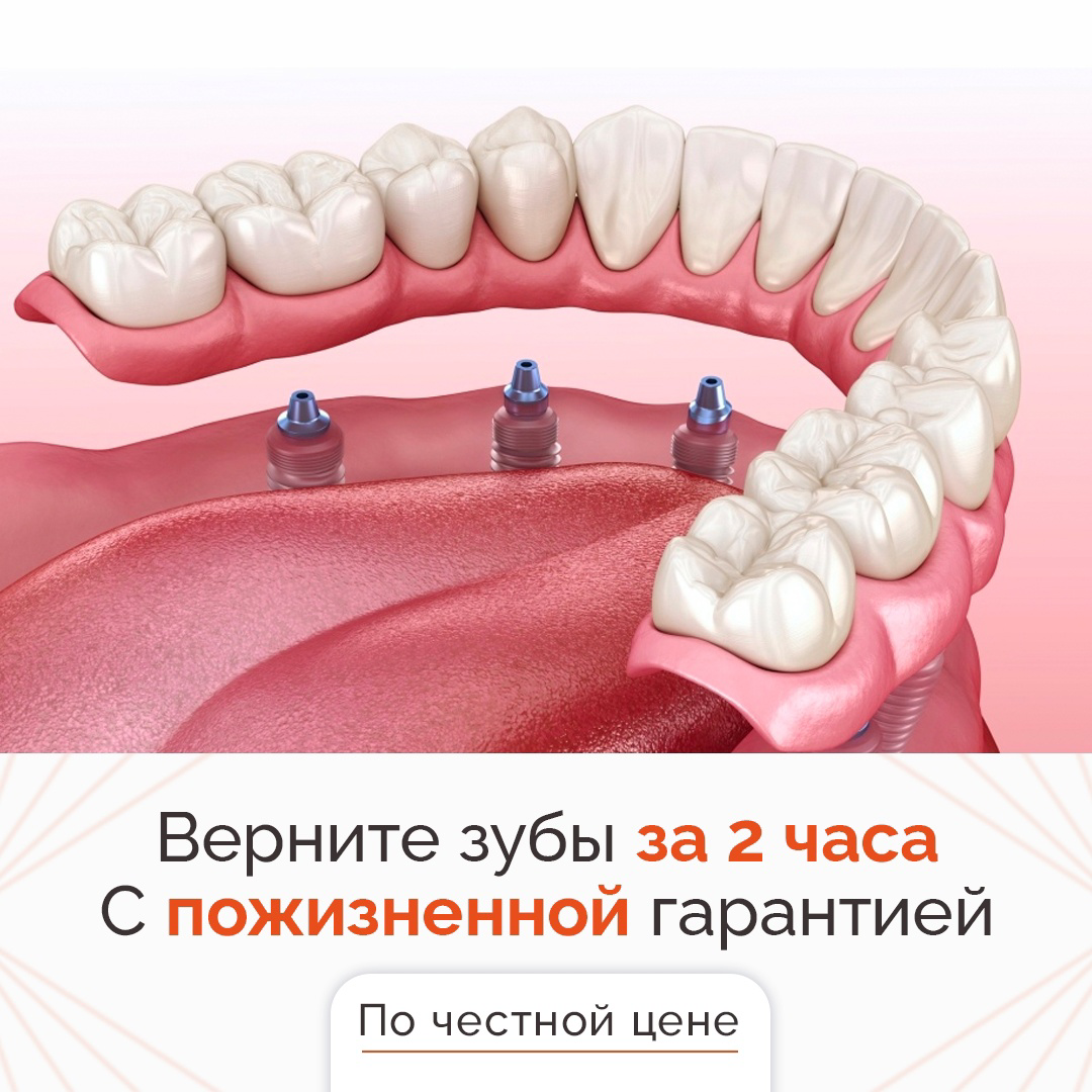 Кейс: 154 заявки в стоматологию из ВКонтакте по 384 рубля — иллюстрация 6